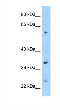 Anti-ZFP664 antibody produced in rabbit