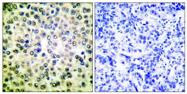 Anti-NF-?B p65 antibody produced in