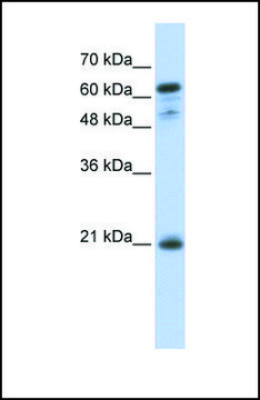 Anti-GCET2 antibody produced in rabbit