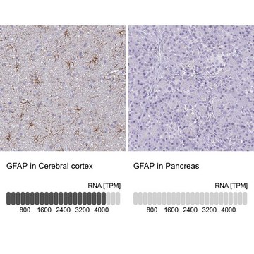 Anti-GFAP antibody produced in rabbit