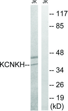 Anti-KCNK17 antibody produced in rabbit