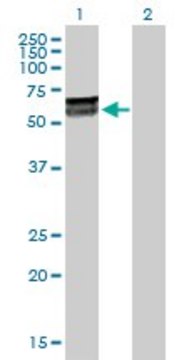 Anti-KLHDC4 antibody produced in rabbit