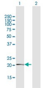 Anti-TMEM126B antibody produced in rabbit