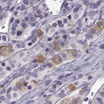 Anti-TRHR antibody produced in rabbit