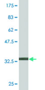 Monoclonal Anti-CMTM4, (C-terminal) antibody produced