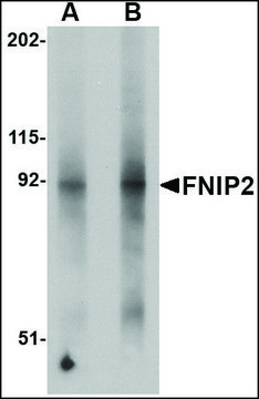 Anti-FNIP2 antibody produced in rabbit