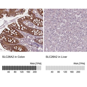 Anti-SLC26A2 antibody produced in rabbit