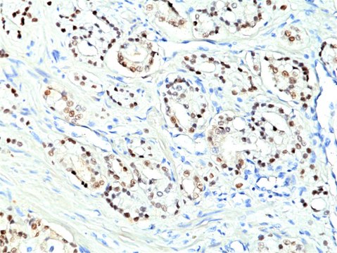 Anti-Nkx3.1 Rabbit Monoclonal Antibody