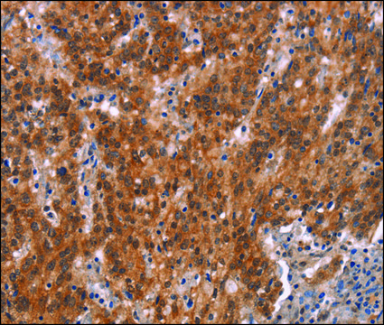 Anti-GNAT3 antibody produced in rabbit