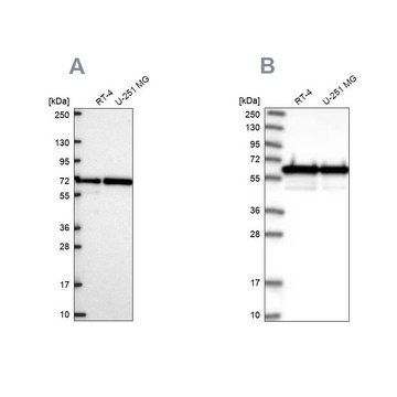 Anti-CCDC47 antibody produced in rabbit
