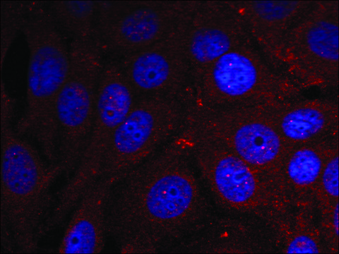 Anti-phospho-SNCA (pTyr¹³?) antibody produced in