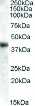 Anti-GOT1 (AA 157-167) antibody produced