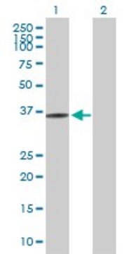Anti-FN3K antibody produced in rabbit