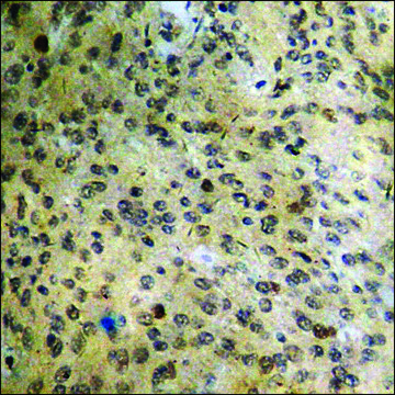 Anti-phospho-ATF2 (pThr69 or 51) antibody