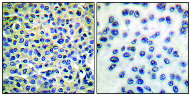 Anti-LIMK1 antibody produced in rabbit