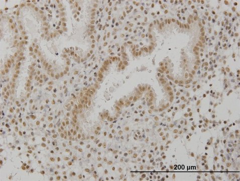 Monoclonal Anti-SCML1 antibody produced in
