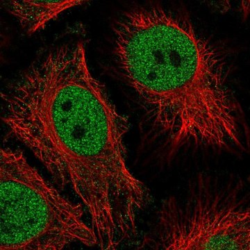 Anti-HMG20B antibody produced in rabbit
