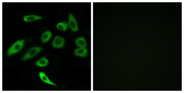 Anti-TAS2R3 antibody produced in rabbit