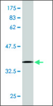 Monoclonal Anti-ASCC2, (C-terminal) antibody produced