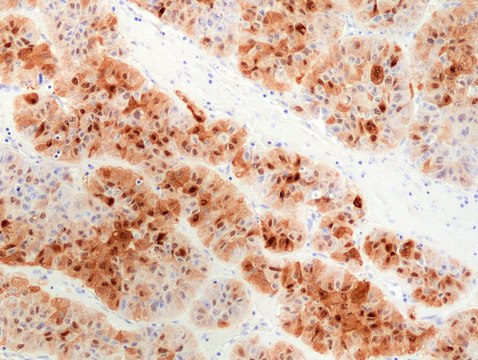 Anti-HSP70 Rabbit Monoclonal Antibody