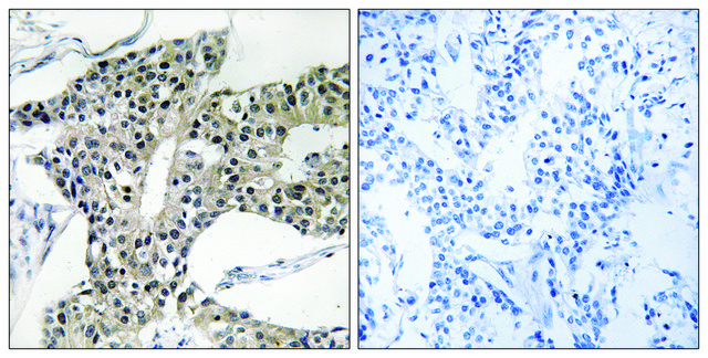 Anti-ARSK antibody produced in rabbit