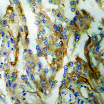 Anti-phospho-Aquaporin 2 (pSer²??) antibody produced