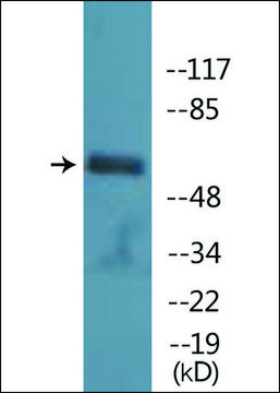 Anti-phospho-PAK1 (pSer¹??) antibody produced in