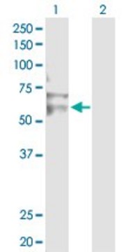 Anti-RNF12 antibody produced in rabbit