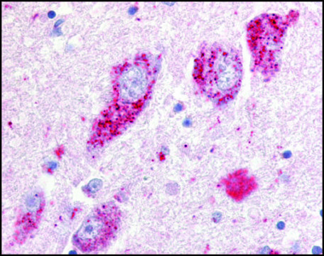 Anti-GPR20 (AB1) antibody produced in