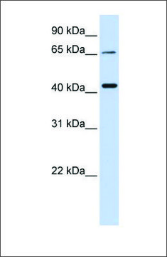 Anti-QPCTL antibody produced in rabbit