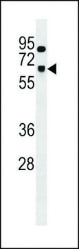 ANTI-SNRNP70 (CENTER) antibody produced in