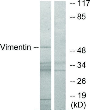 Anti-Vimentin antibody produced in rabbit
