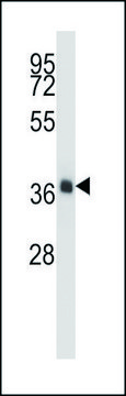 ANTI-NKX2-4 (N-TERM) antibody produced in