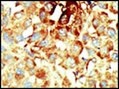 Anti-SENP5 (N-term) antibody produced in