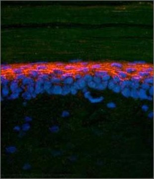 Anti-SMAD2, (N-terminal) antibody produced in