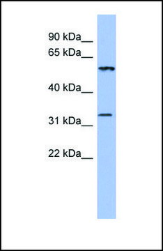 Anti-DDC antibody produced in rabbit