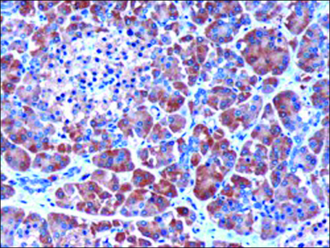 Anti-MEPI/SERPINI2 antibody produced in goat