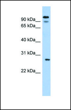 Anti-VDAC3, (N-terminal) antibody produced in