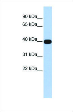 Anti-LMX1A antibody produced in rabbit