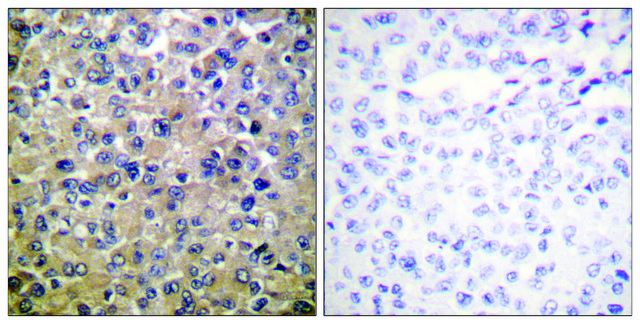 Anti-PP1-? antibody produced in rabbit
