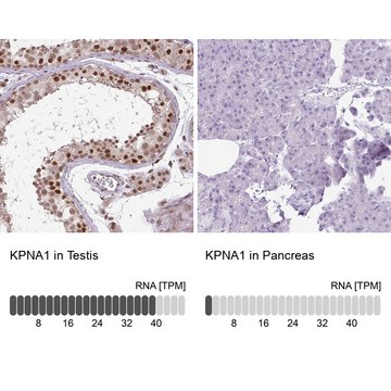 Anti-KPNA1 antibody produced in rabbit