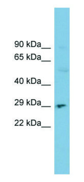 Anti-DNASE1 (N-terminal) antibody produced in