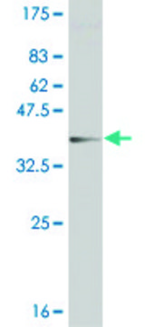 Monoclonal Anti-CRYGC, (C-terminal) antibody produced
