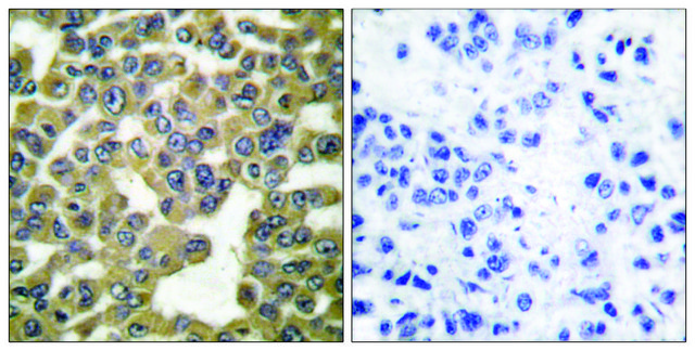 Anti-MMP-13 antibody produced in rabbit