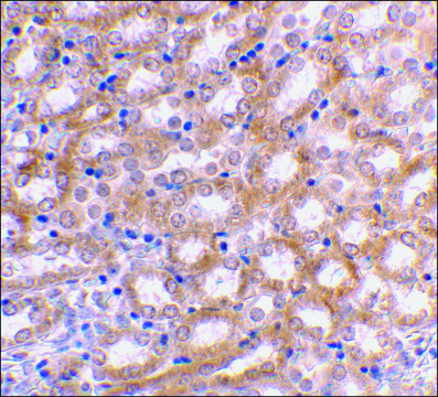 Anti-IRF3 antibody produced in rabbit
