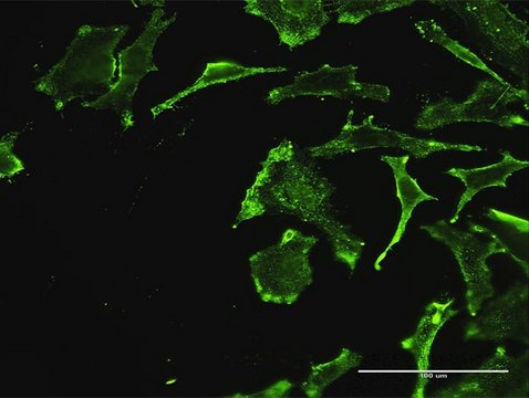 Monoclonal Anti-REN, (C-terminal) antibody produced