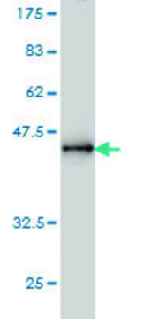 Monoclonal Anti-PPM1D antibody produced in