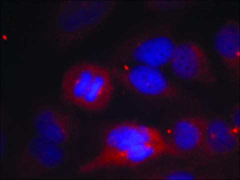 Anti-phospho-TH (pSer??) antibody produced in