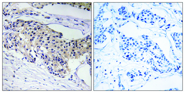 Anti-NDUFA3 antibody produced in rabbit
