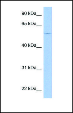 Anti-TRIM58 antibody produced in rabbit